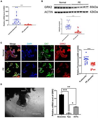 Role of GRK2 in Trophoblast Necroptosis and Spiral Artery Remodeling: Implications for Preeclampsia Pathogenesis